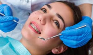 Orthodontist in Boca Raton